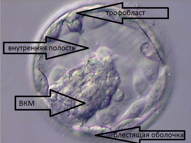 Фото Эмбриона На 5